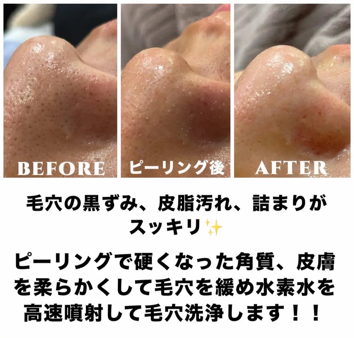 エステ リラク ネイル・エステサロン UILANIのエステ・リラクイメージ