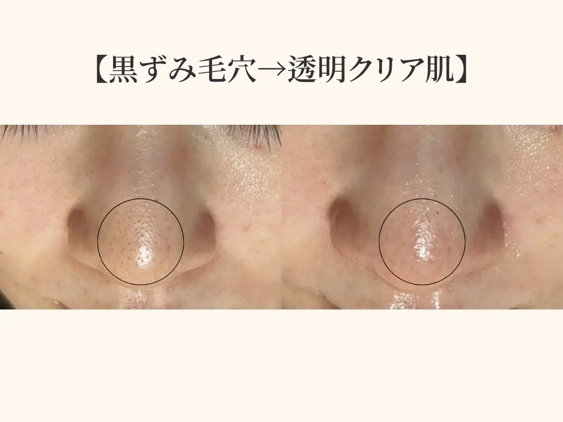 小顔矯正×毛穴サロン DRRAMSPA町田のエステ・リラクイメージ