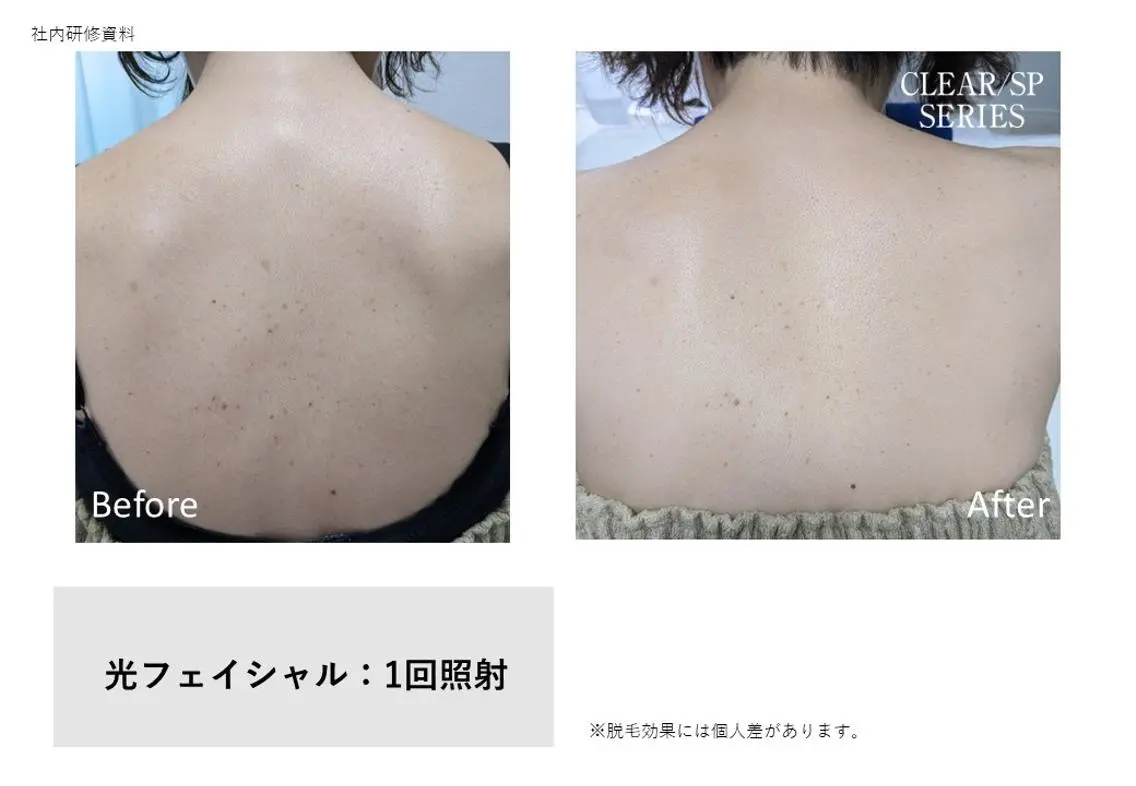 TOTALCLEAR KAORIのエステ・リラクイメージ