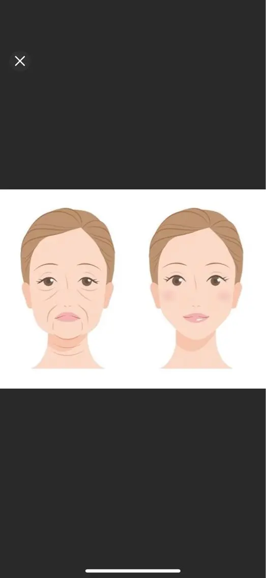 エステ ITO  SALON 小顔・痩身・肌質改善のエステ・リラクイメージ