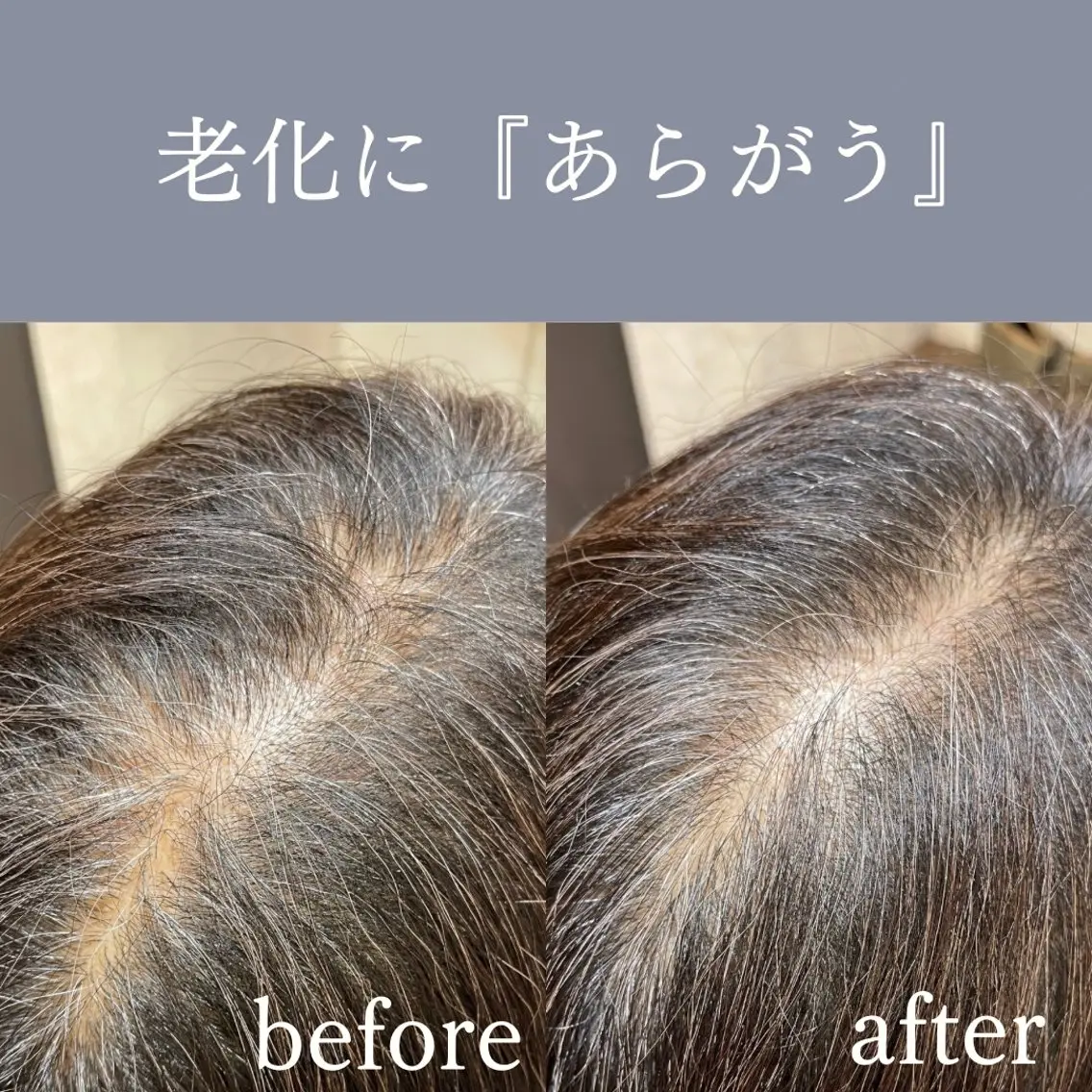 【ご新規様限定】頭皮診断付き🔍エイジングスパ🍵あらがうコース🕰️60分の写真