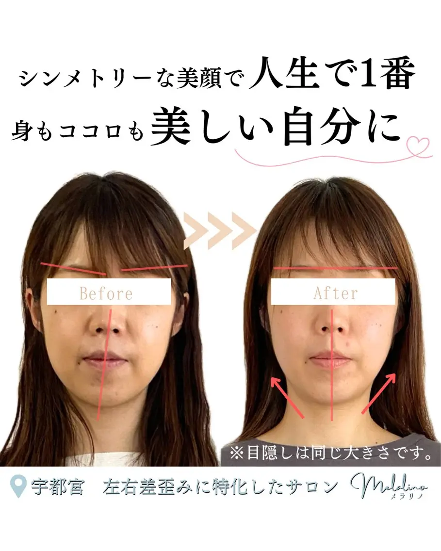 エステ リラク 美容整体サロン Melalinoのエステ・リラクイメージ
