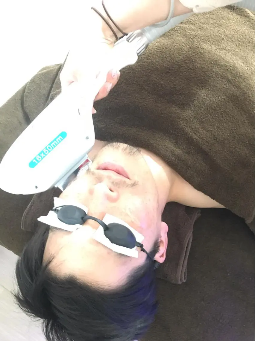 【男性限定】どこでも1カ所3800円(VIOは除く)お気軽にお問い合わせ下さい♪の写真