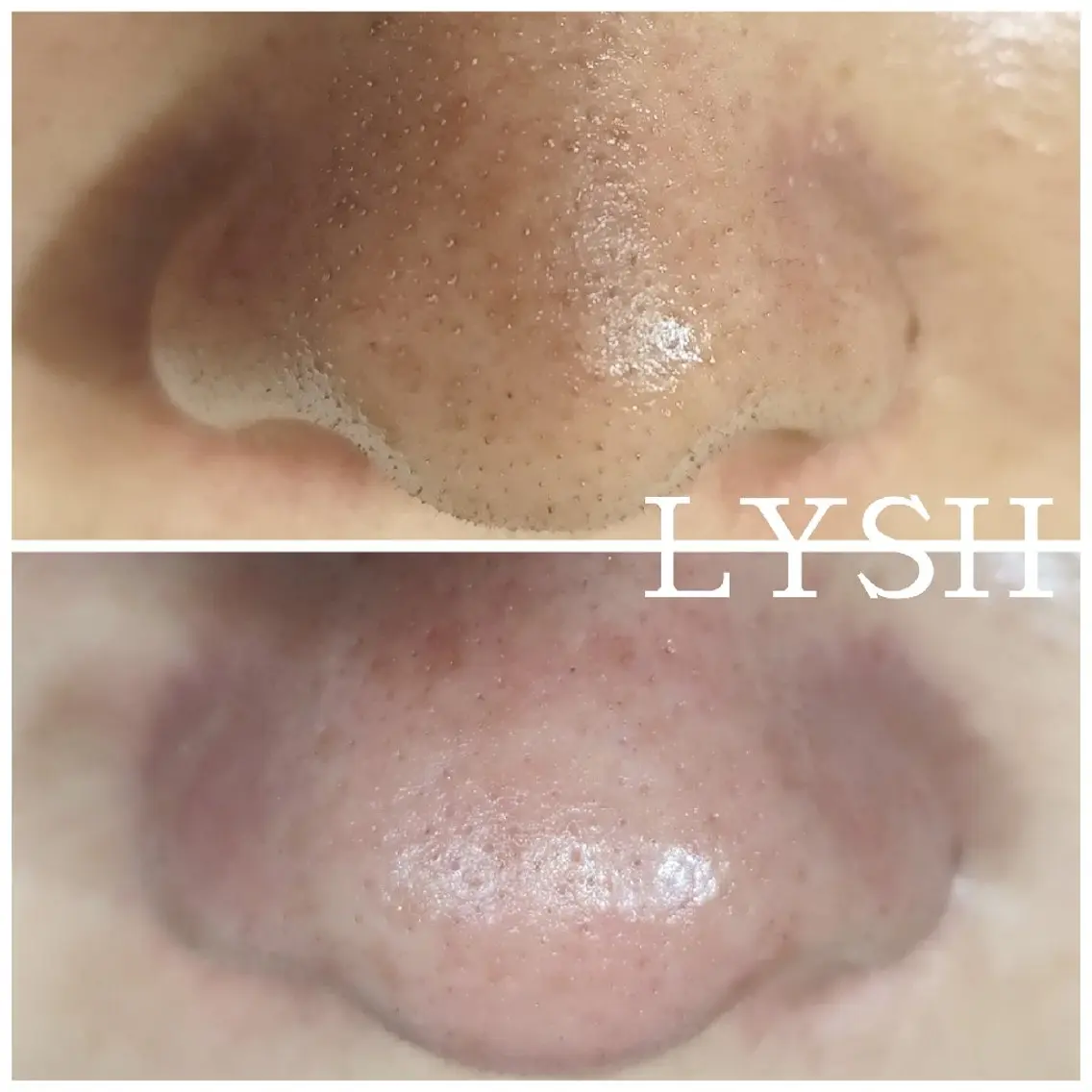 エステサロン LYSH愛名のエステ・リラクイメージ
