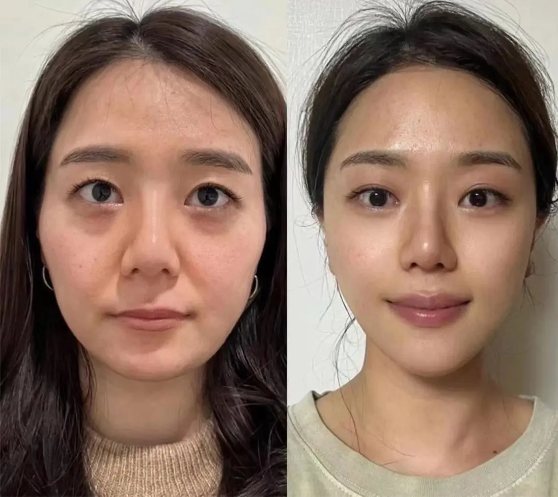 マツエク・マツパ エステ リラク 愛維美水光美肌専門店 メンズレディースokのエステ・リラクイメージ