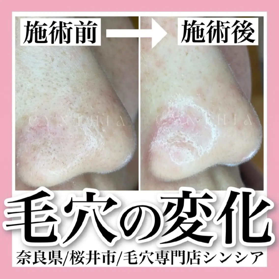 メンズ 毛穴ケア専門店 Cynthiaのエステ・リラクイメージ