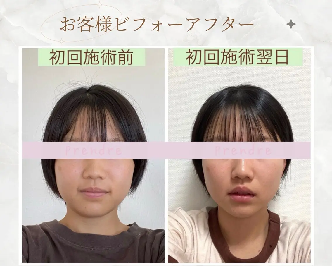 小顔にスッキリ⤴️💕💎｢カワ見えをつくる✨️小顔矯正マッサージ」💆‍♀️初回🔰の写真