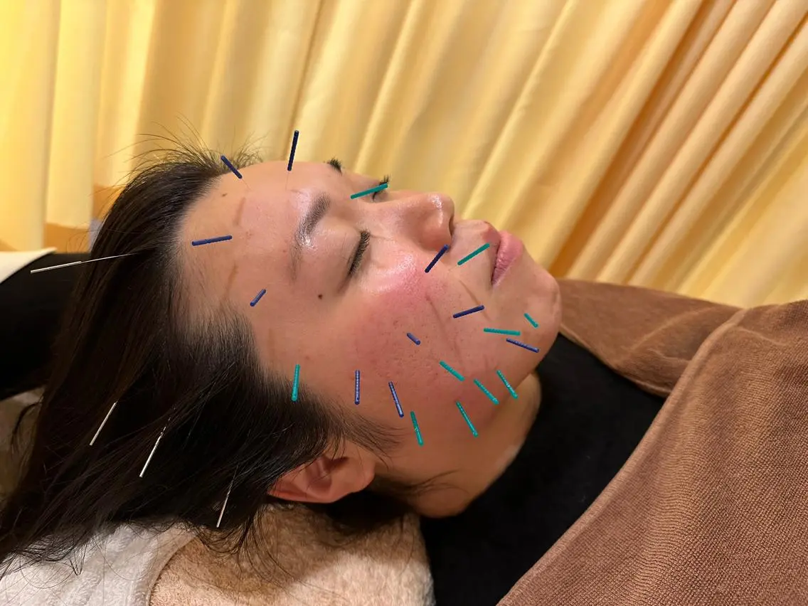 その他 鍼灸サロン BBB3のその他イメージ