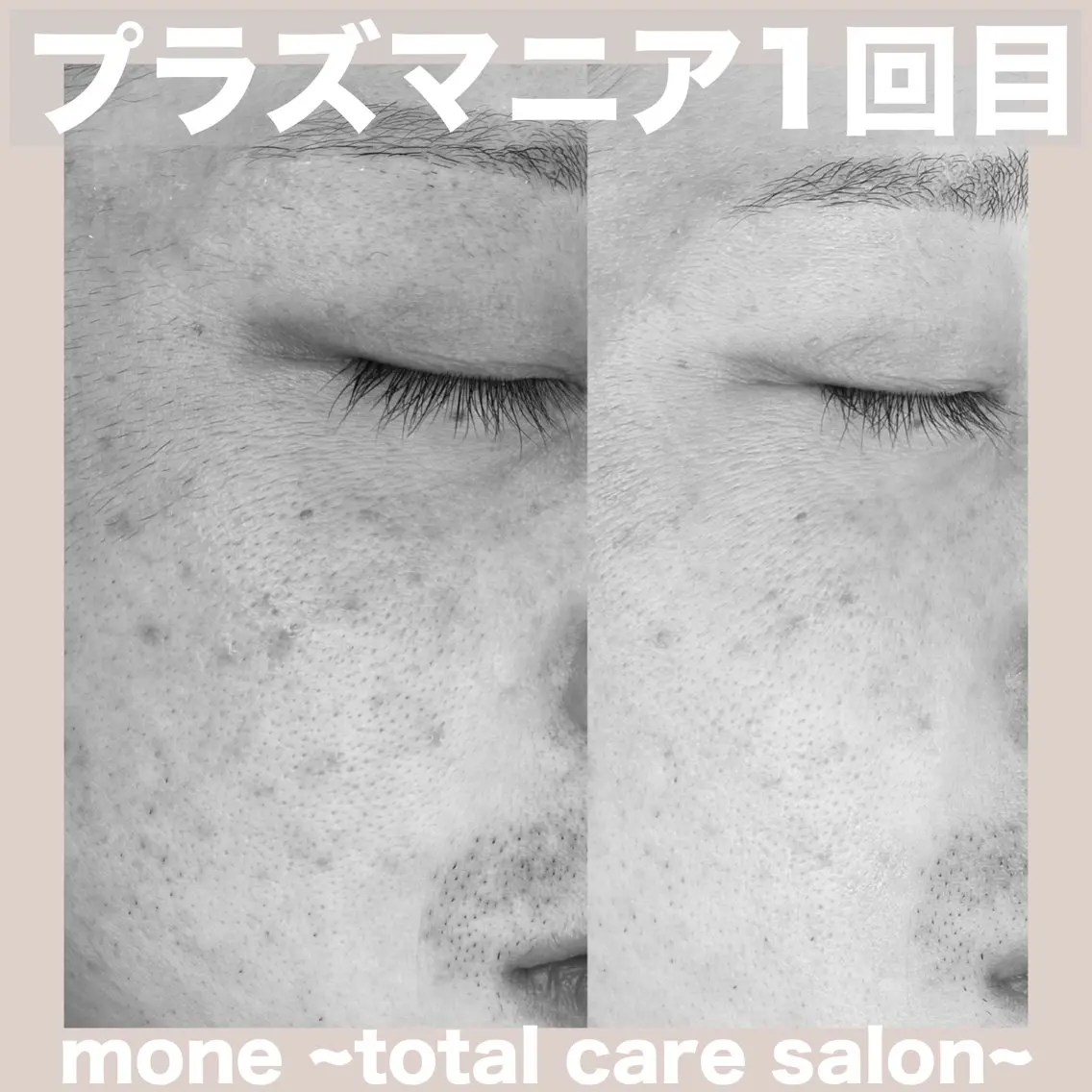 エステ mone (モーネ)のエステ・リラクイメージ