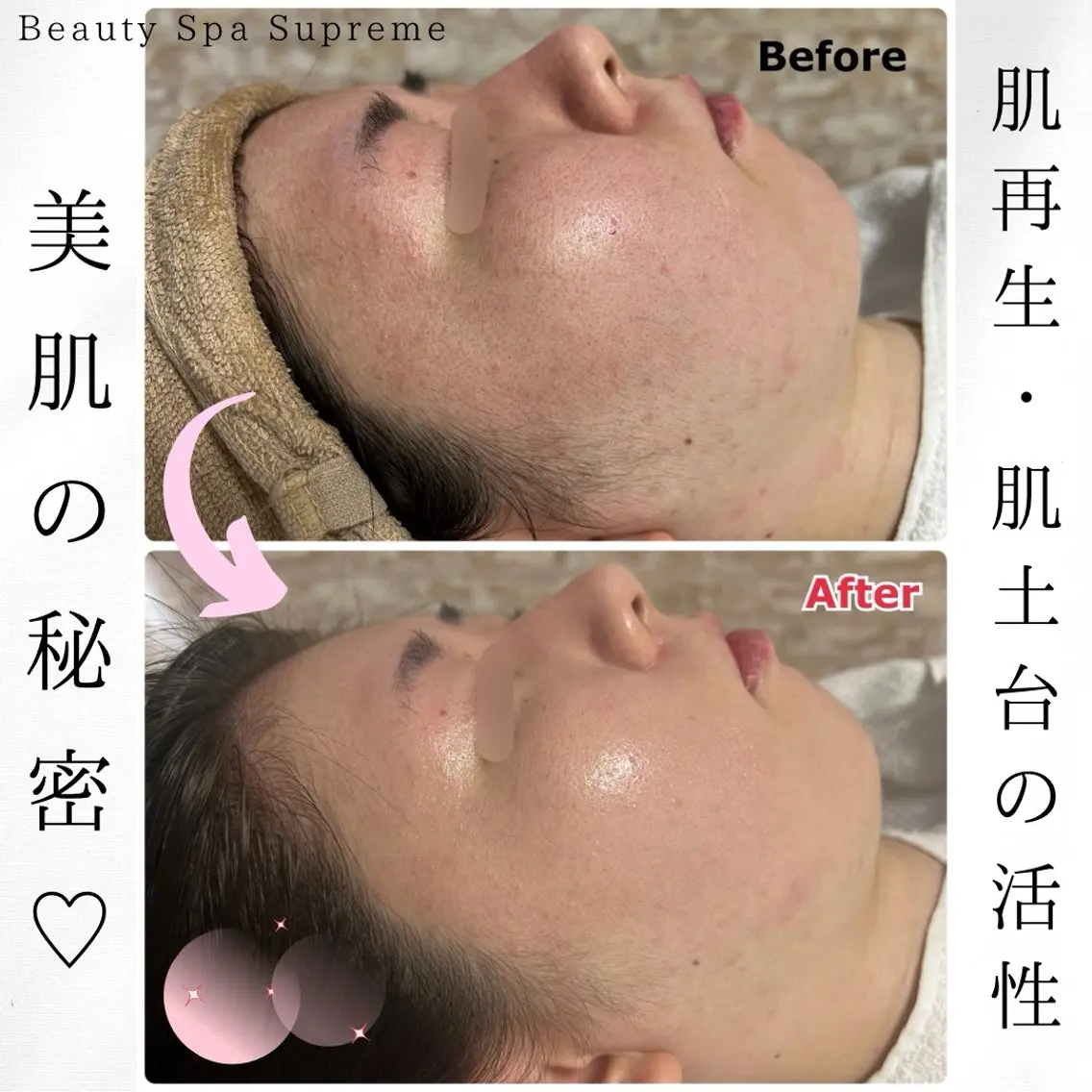 Beauty Spa Supreme小玉のエステ・リラクイメージ