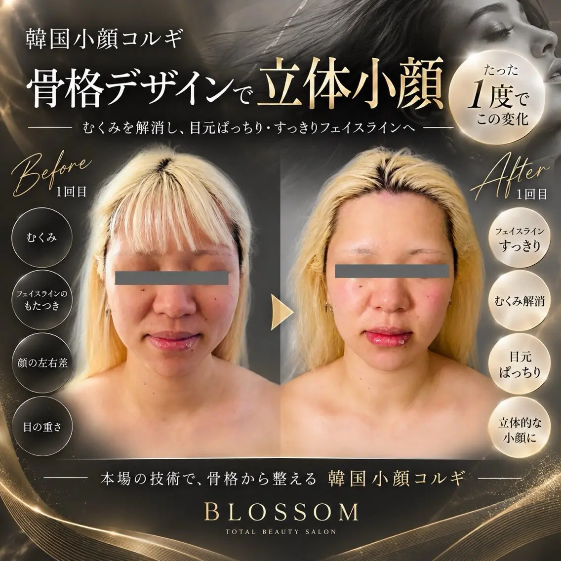 BLOSSOM 菊地のその他イメージ