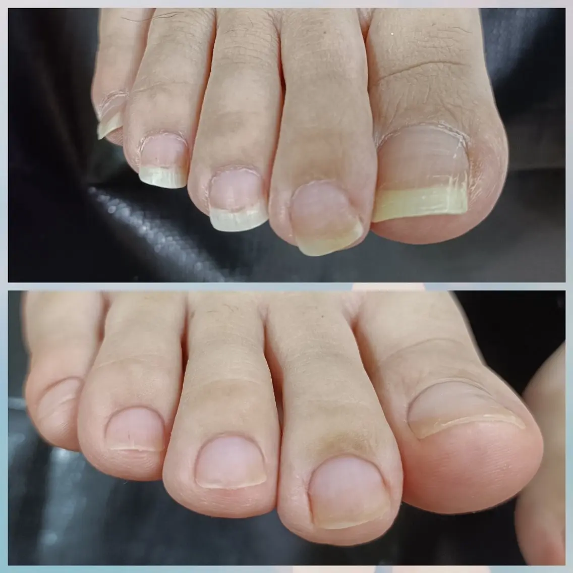 ネイル フットネイル フットネイル その他(ネイル) 最終受付23時半 benny nailのネイルデザイン