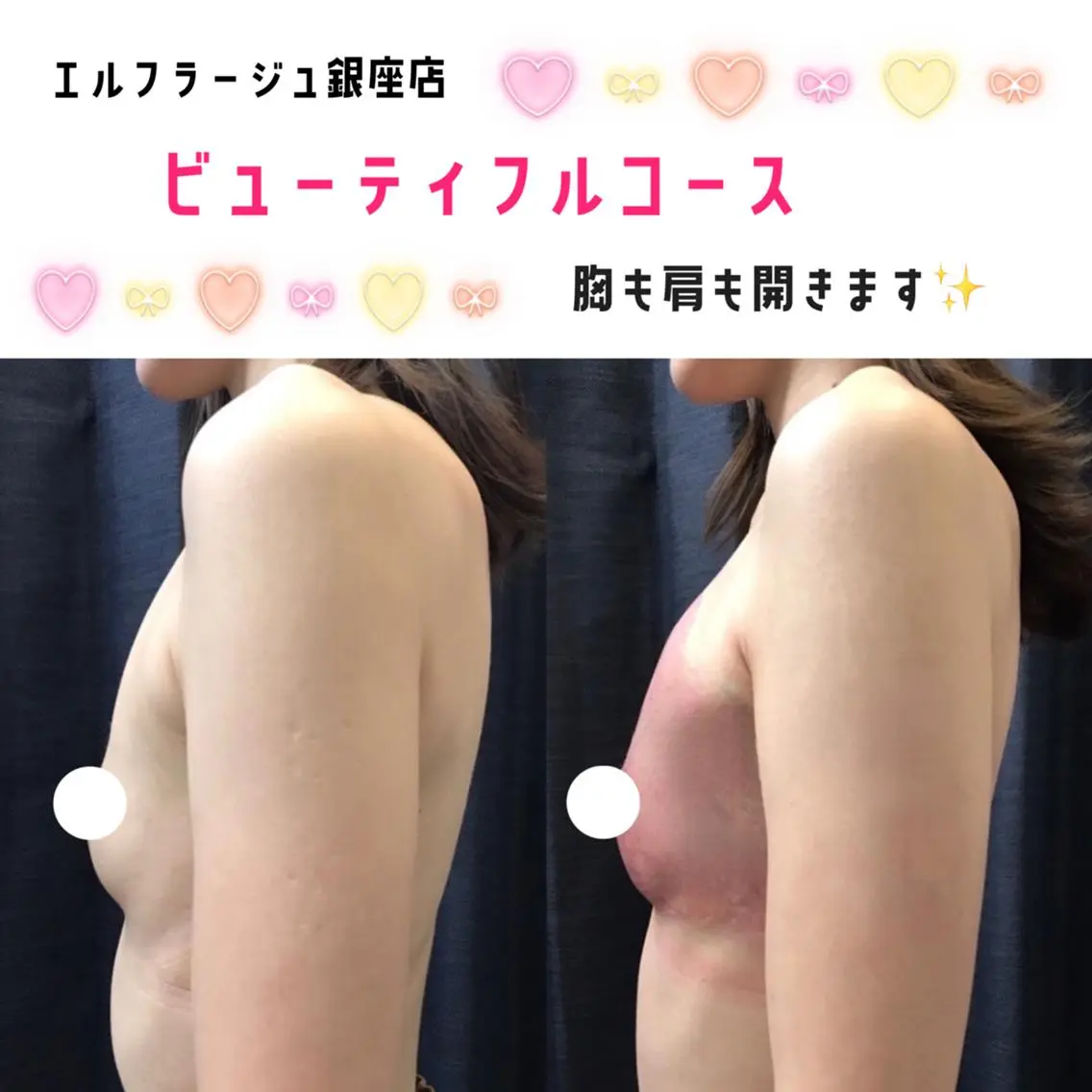 エルフラージュ 銀座店のエステ・リラクイメージ