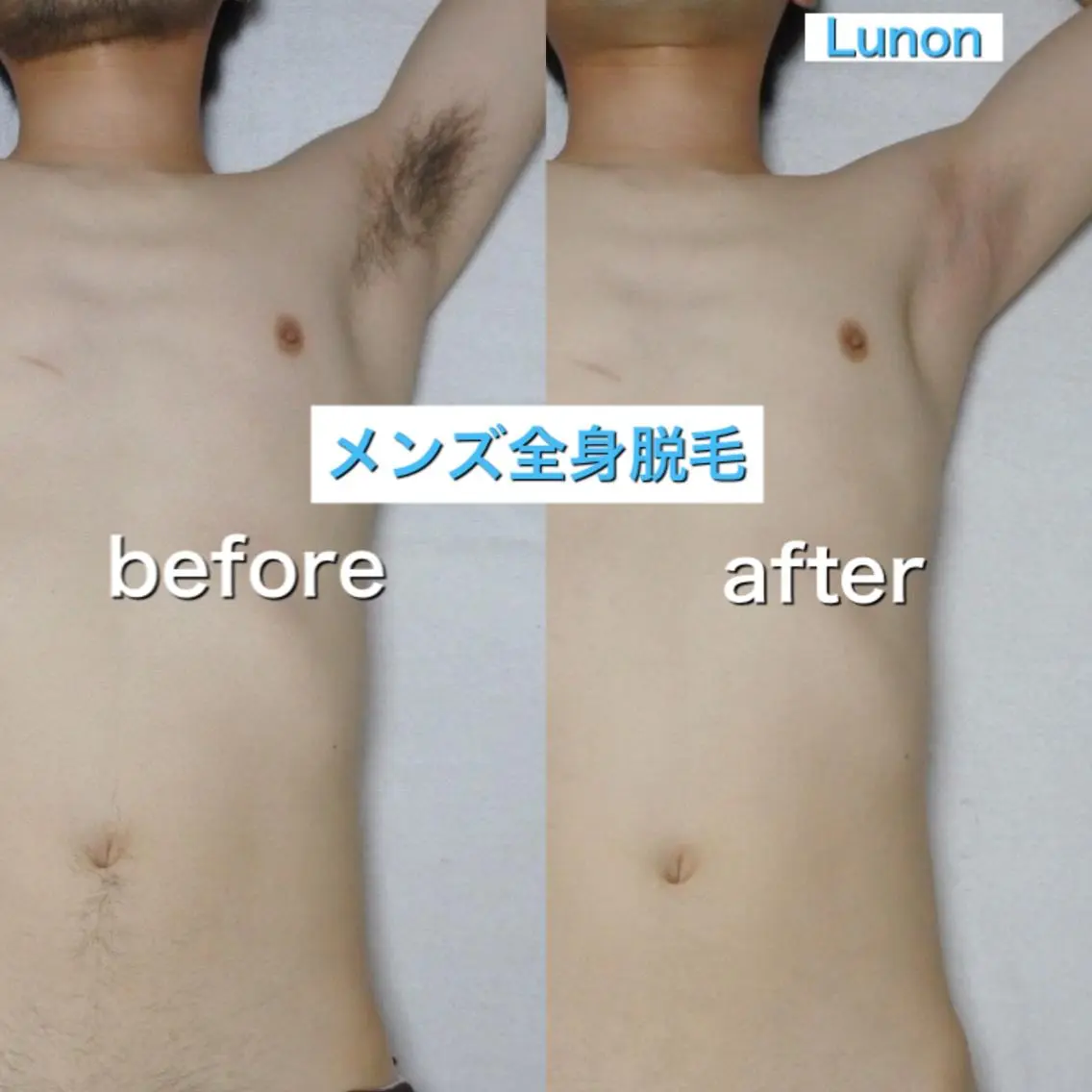 Lunon 【ルノン】のエステ・リラクイメージ