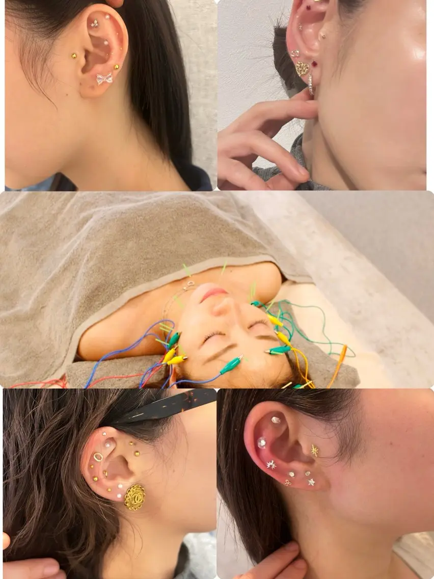 🉐話題の耳ツボジュエリー💎つけ放題×電気美容鍼✨おしゃれ小顔リフトケア｜学生−1000円👂👂の写真