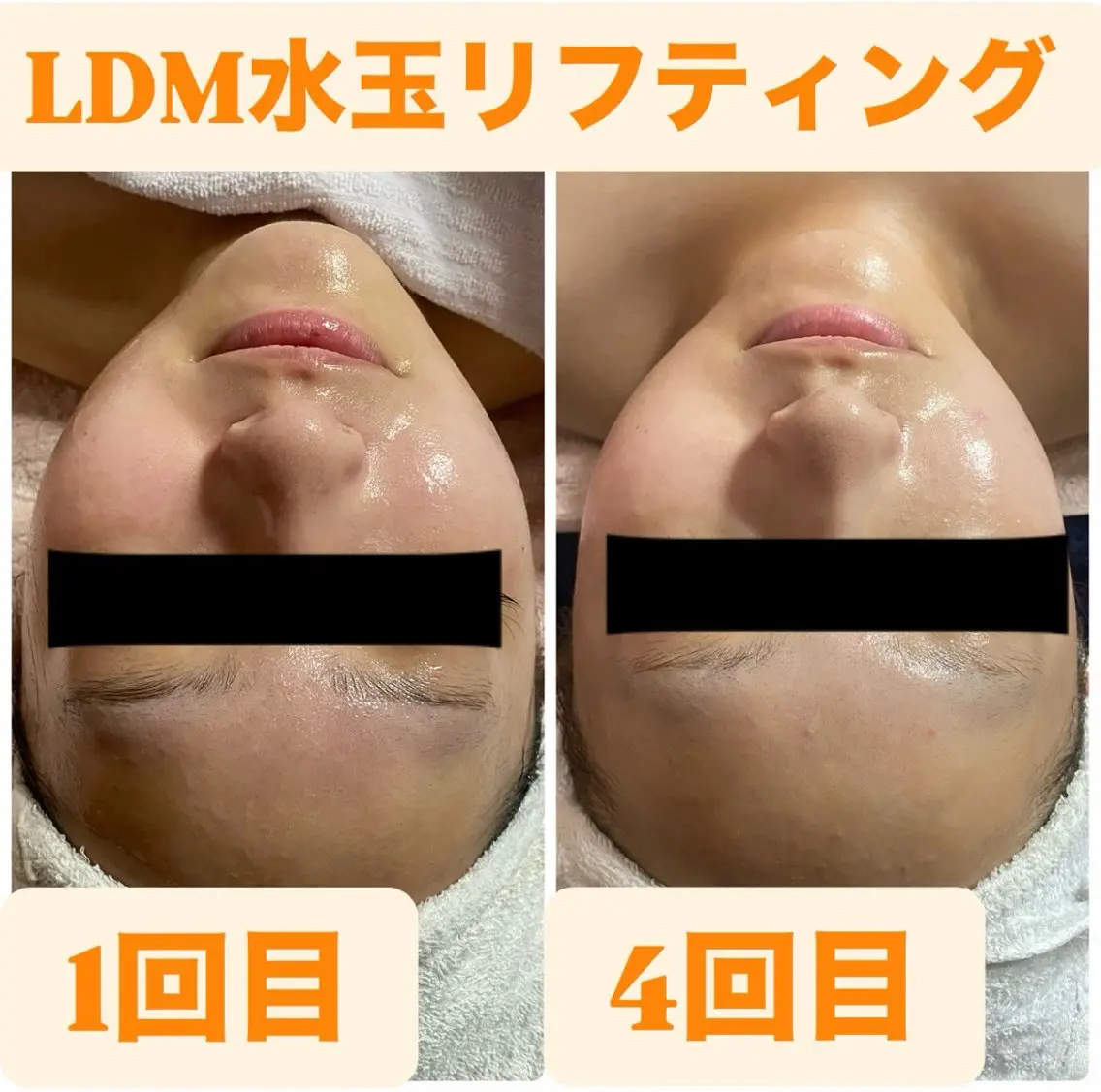 エステ 小西 綾香のエステ・リラクイメージ