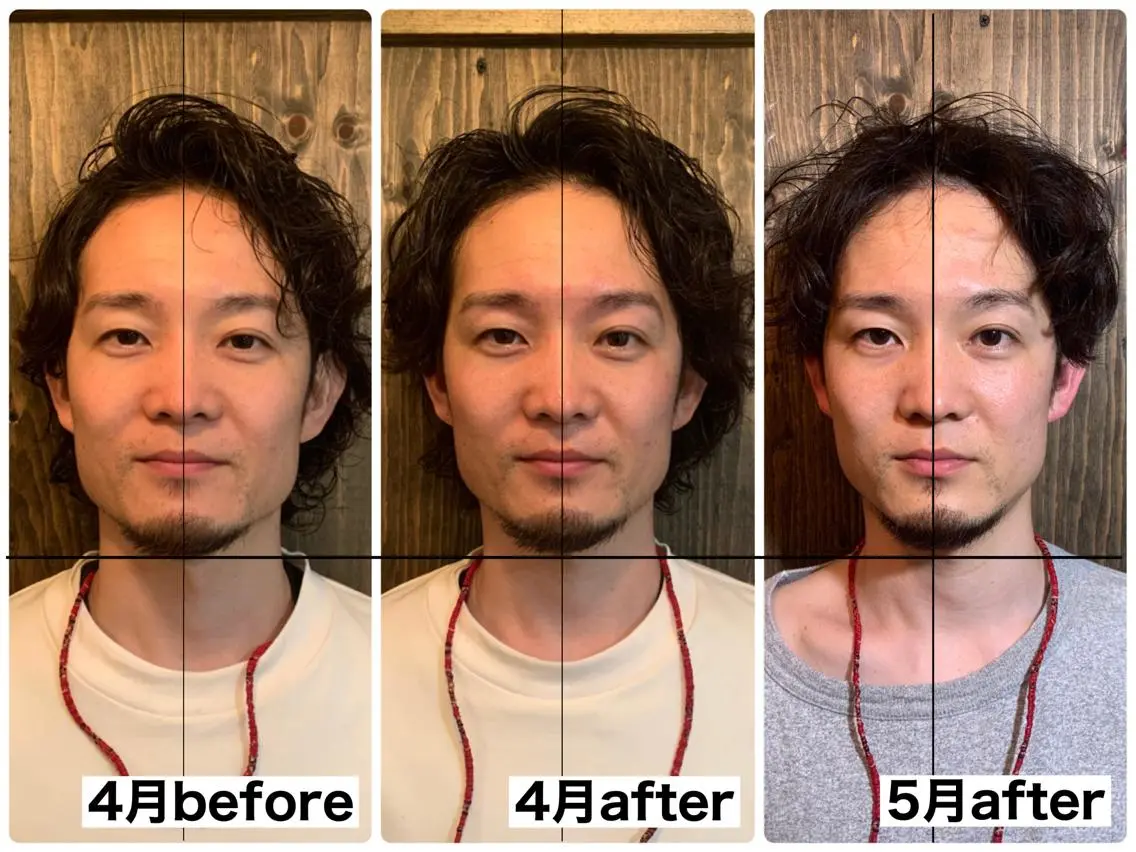 エステ リラク 💎後悔させない小顔 矯正💎イトヤマ🌱のエステ・リラクイメージ