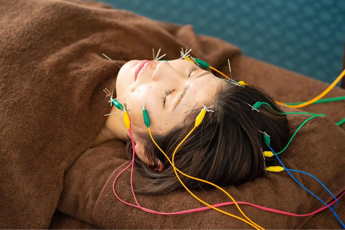 電気を流す美容鍼＋初診カウンセリング　　☘️初回の方限定☘️の写真