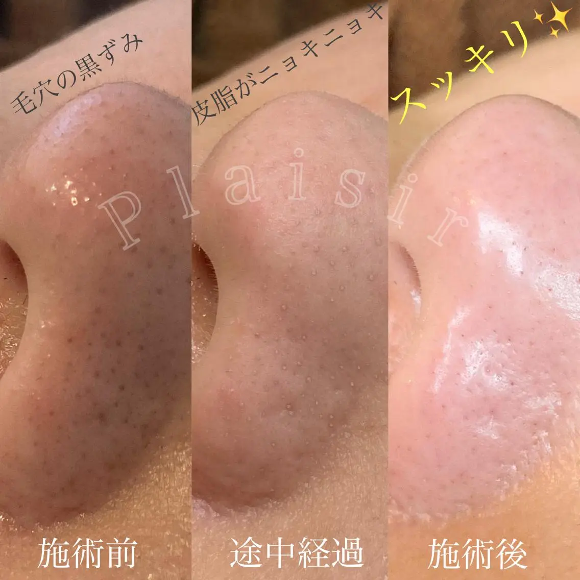 ツカハラ ミカのエステ・リラクイメージ