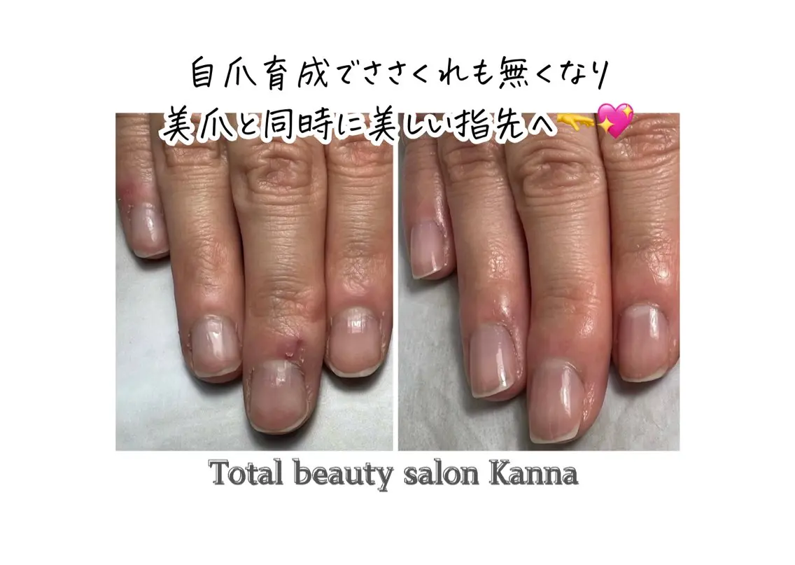 ネイルケアで自爪育成♡の写真