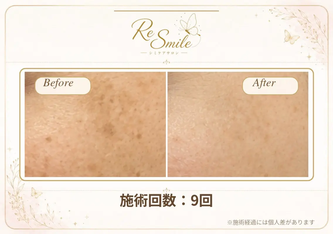 ReSmile (リスマイル)のエステ・リラクイメージ