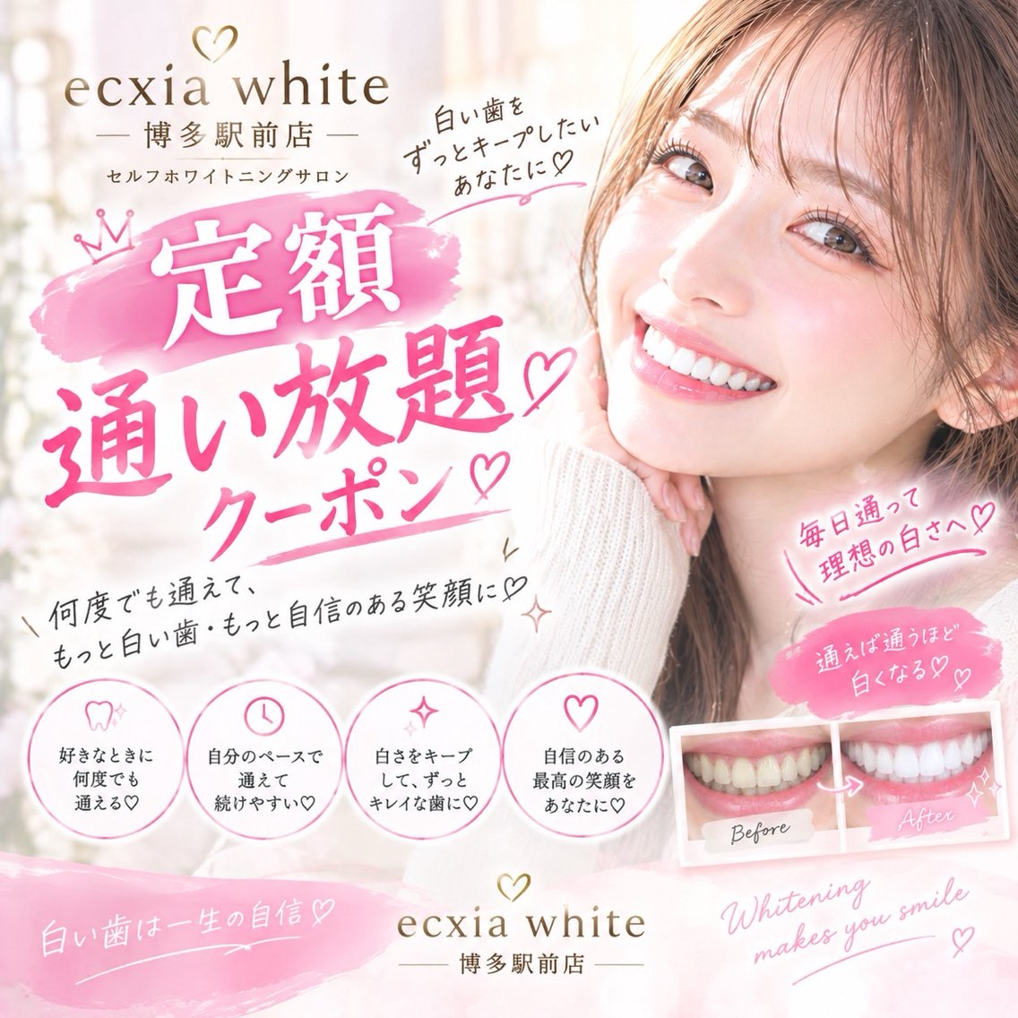 【定額★通い放題】セルフホワイトニング¥11000/月の写真