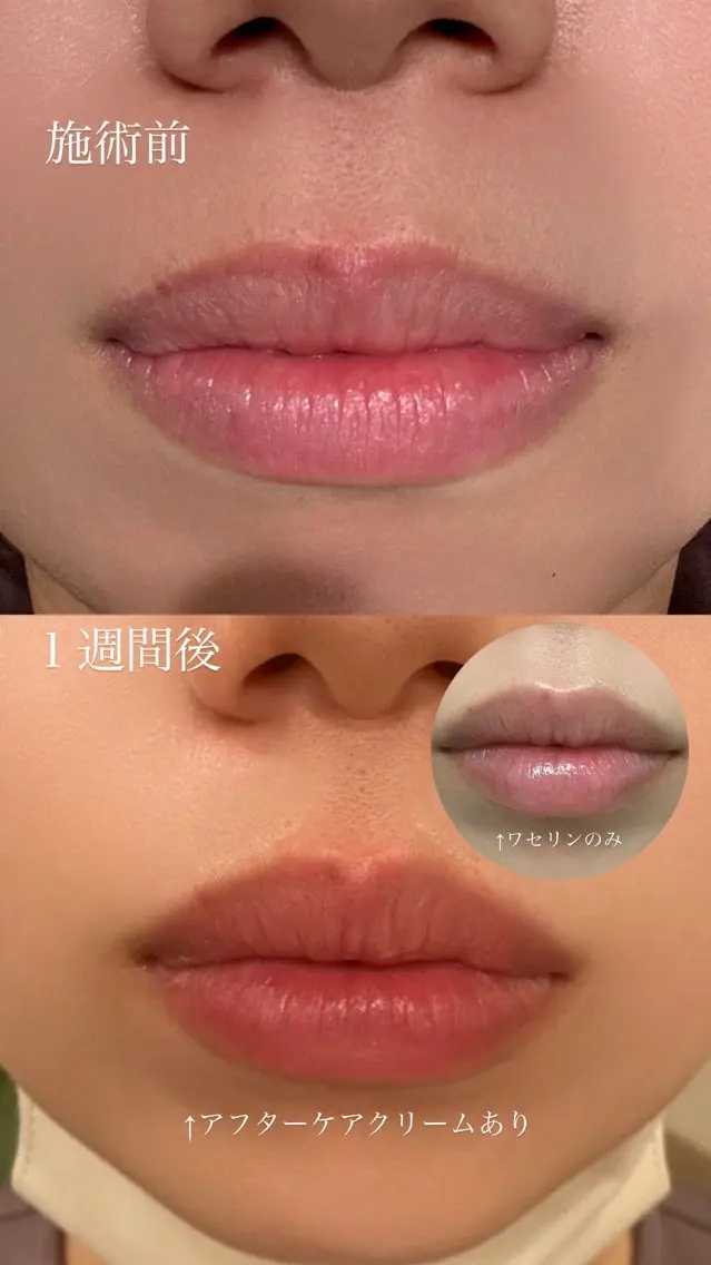 その他 癒し&美活サロン COALALU麻布のエステ・リラクイメージ