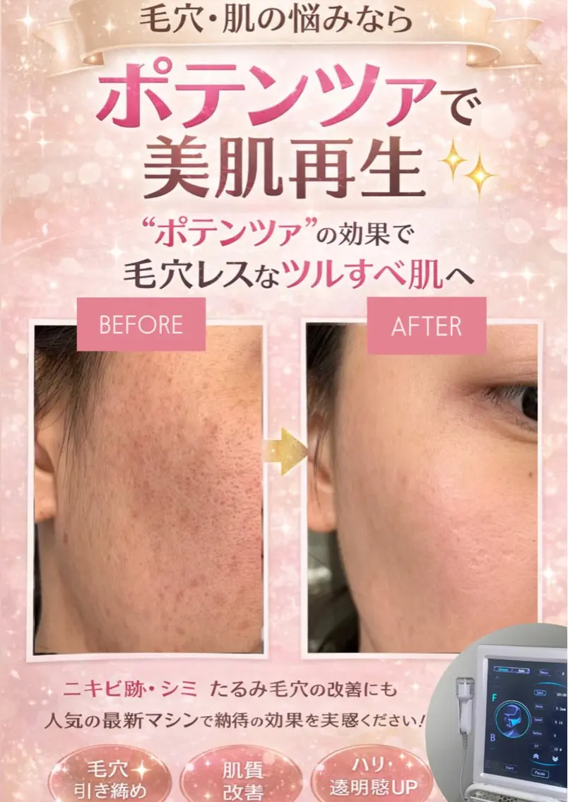 マツエク・マツパ エステ 愛維美水光美肌専門店 メンズレディースokのエステ・リラクイメージ