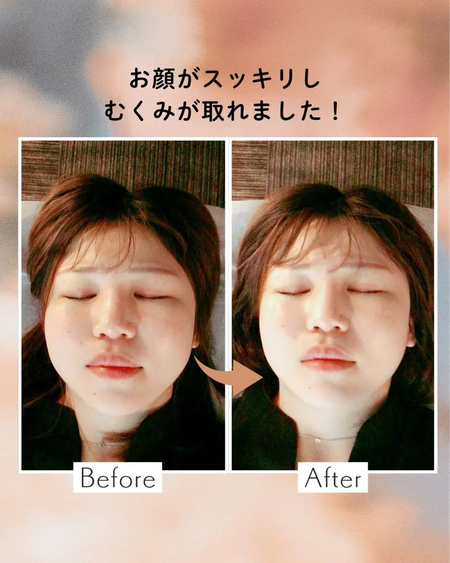 山﨑 竜二のエステ・リラクイメージ