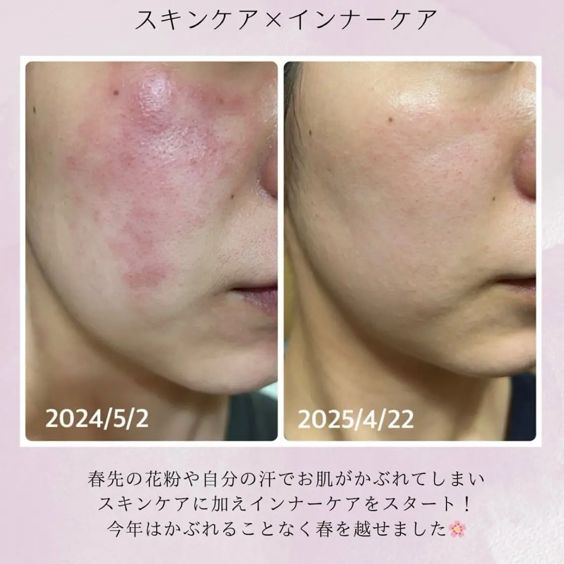 ナリス化粧品 Yumenaのエステ・リラクイメージ
