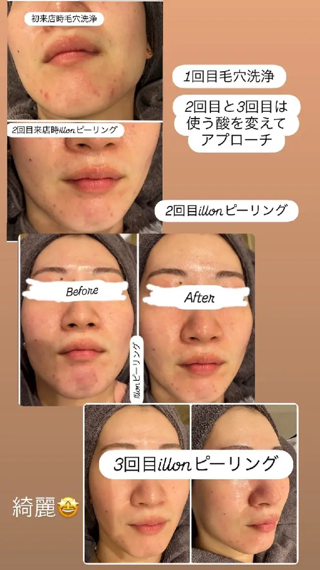 エステ 看護師 桐山 まどかのエステ・リラクイメージ