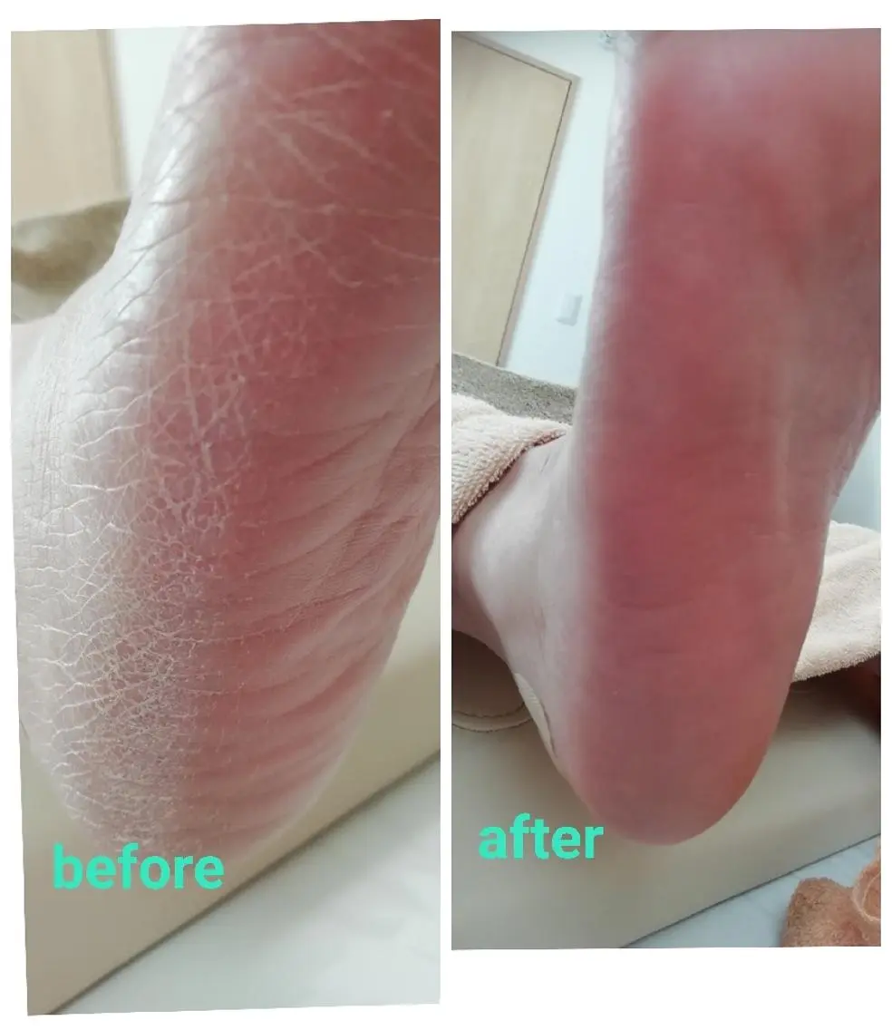 角質＋爪ケア60分の写真