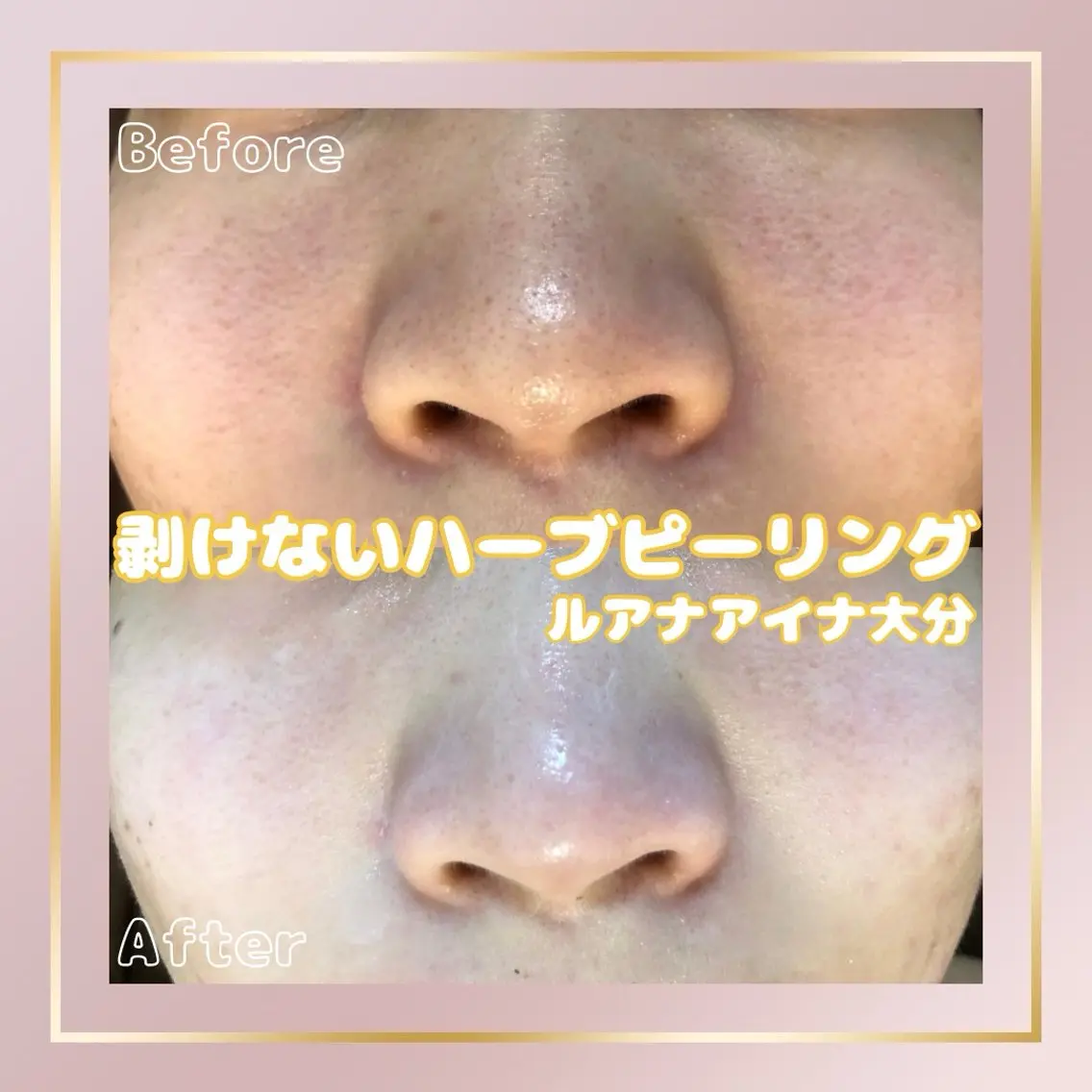 ルアナアイナ 大分のエステ・リラクイメージ
