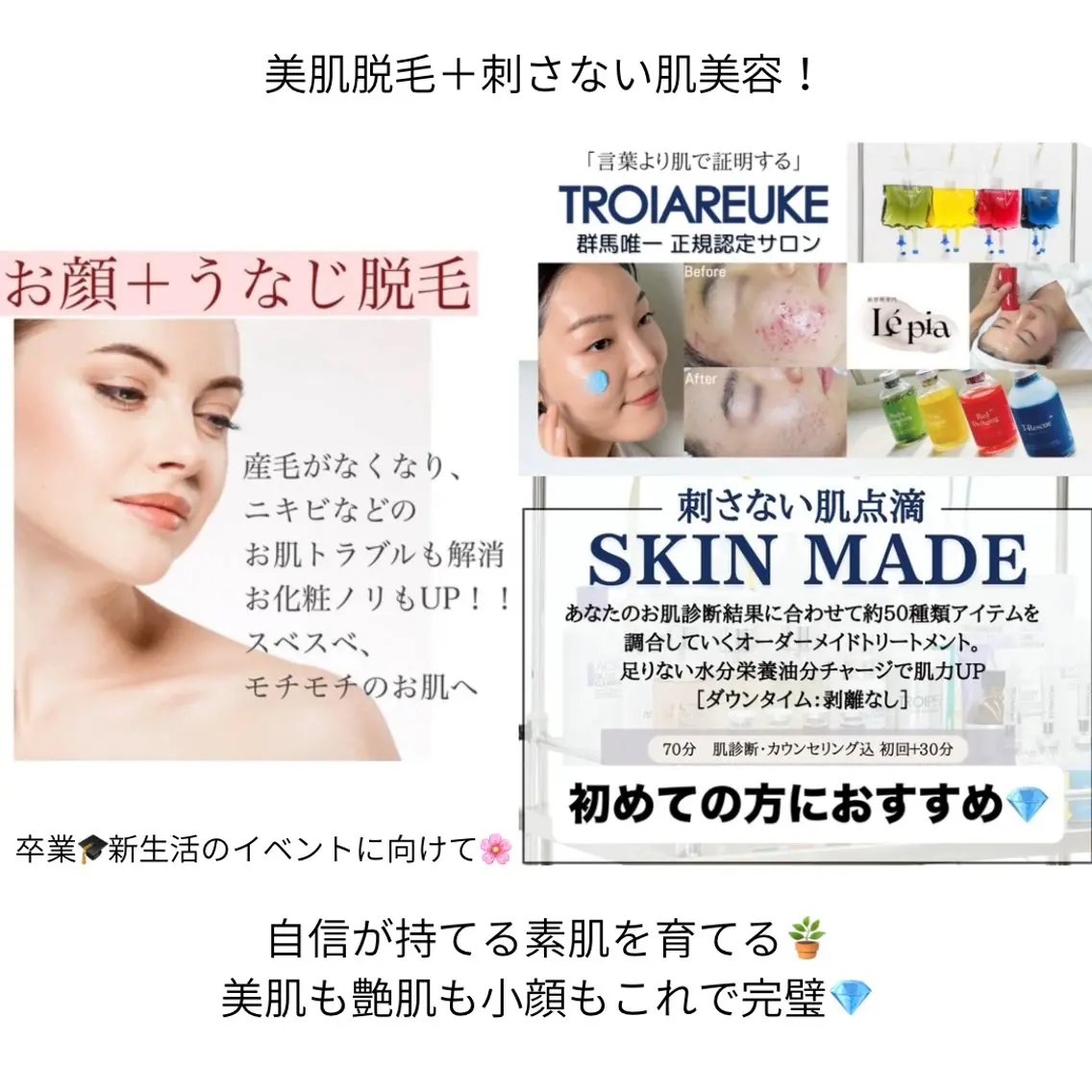 【顔＆うなじ脱毛＋美肌ケア】イベント前に♡当日のメイクノリバッチリ✨小顔マッサージ＆デコルテ・頭皮マッサージ込の写真