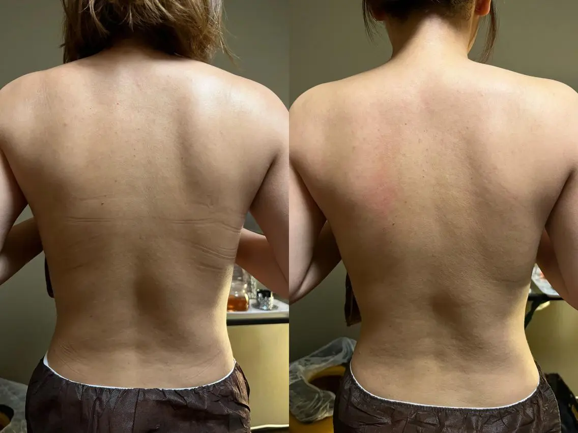 エステ リラク lymph care 'Welnəsのエステ・リラクイメージ