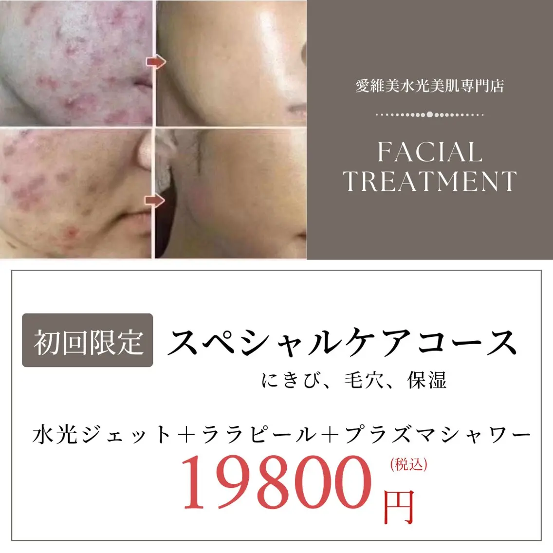 マツエク・マツパ エステ リラク 愛維美水光美肌専門店 メンズレディースokのエステ・リラクイメージ