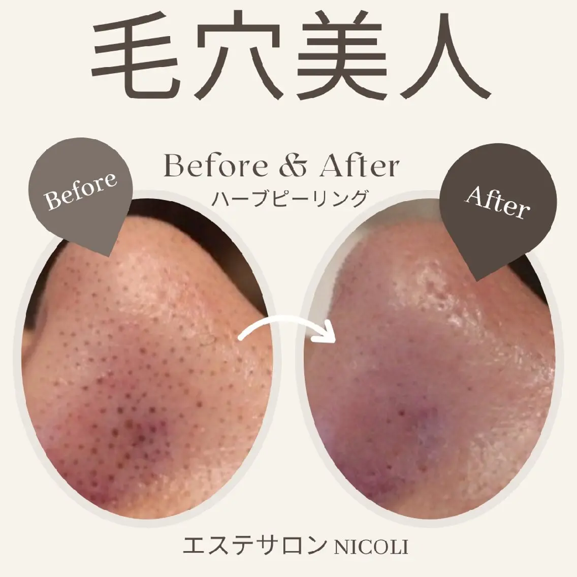 エステサロン NICOLIのエステ・リラクイメージ