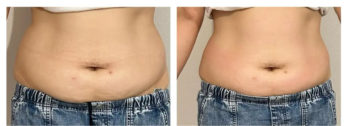 【3名様限定】体の疲労、浮腫にさよなら👋 60分  通常11,000円→初回3,980円の写真