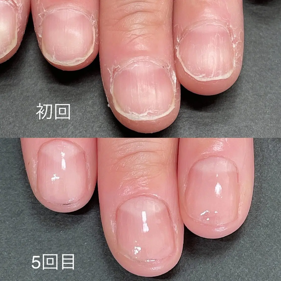 ネイル ハンドケア 関山 志乃のネイルデザイン