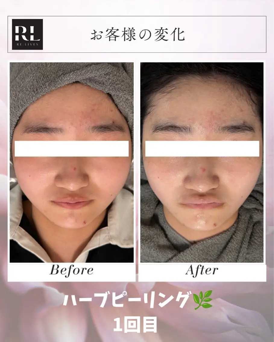 エステ Re:Lives金町 RENAのエステ・リラクイメージ