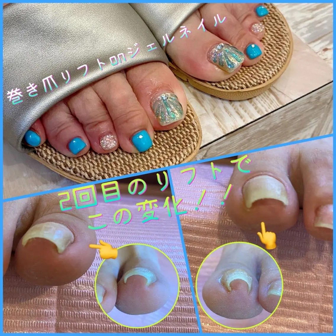 ネイル フットネイル 持ち込み 夏ネイル ♢ME2ROOM♢ #巻き爪#リラクのネイルデザイン