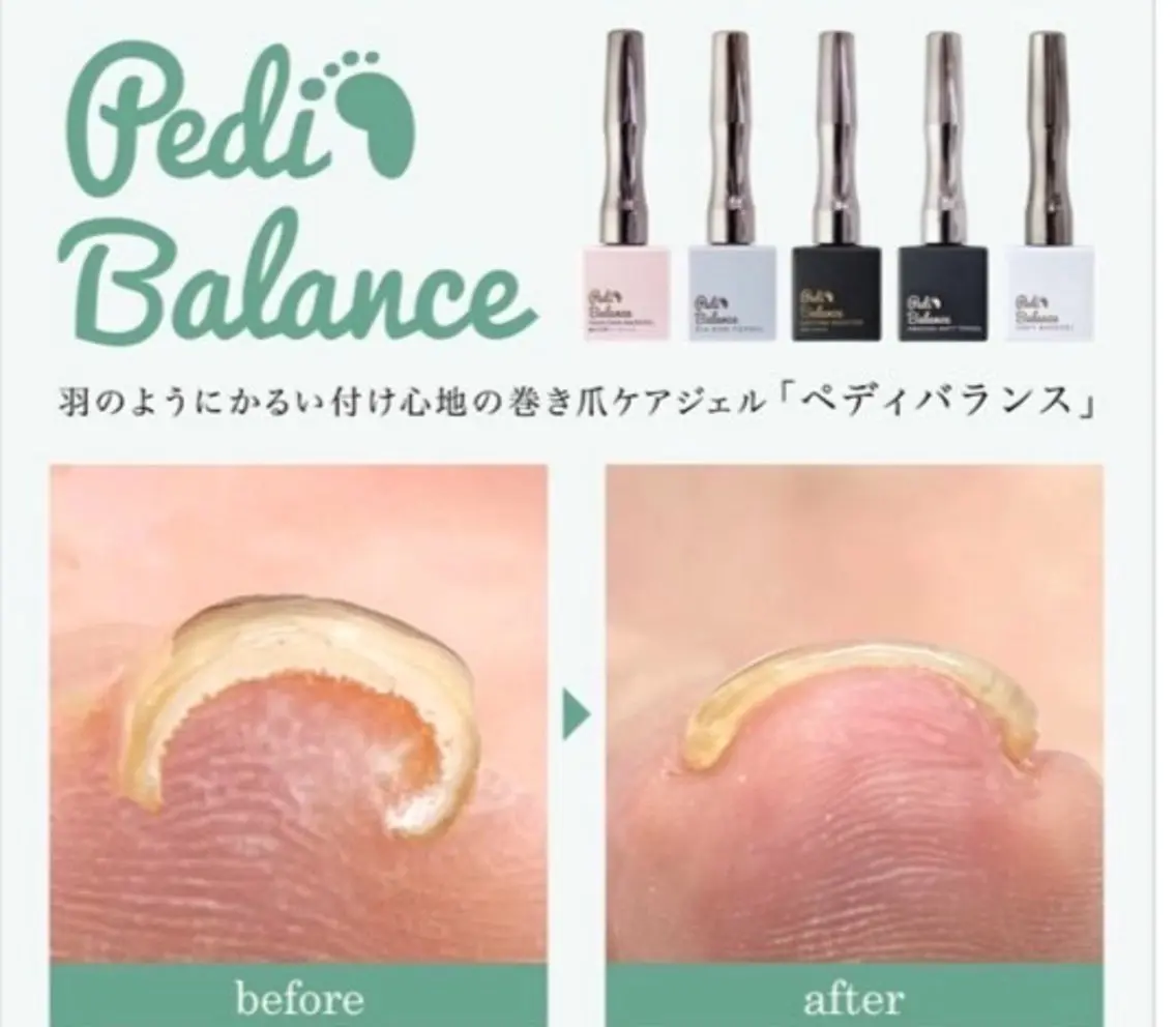 【オフ有り】ジェルネイルフット巻き爪ケア:ペディバランス🦶✨の写真