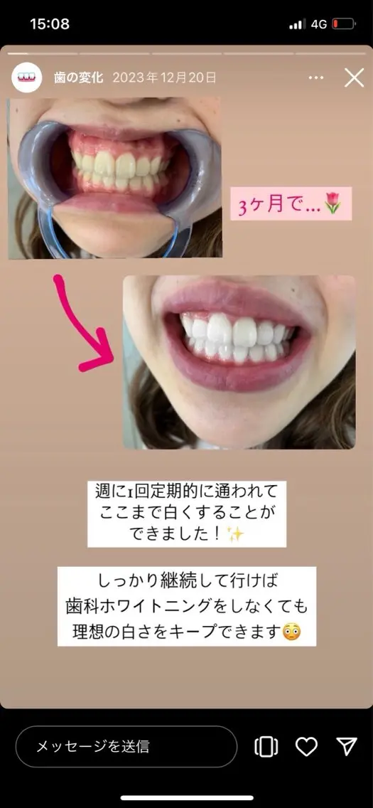 セルフホワイトニング エクシア秋田大町店のその他イメージ