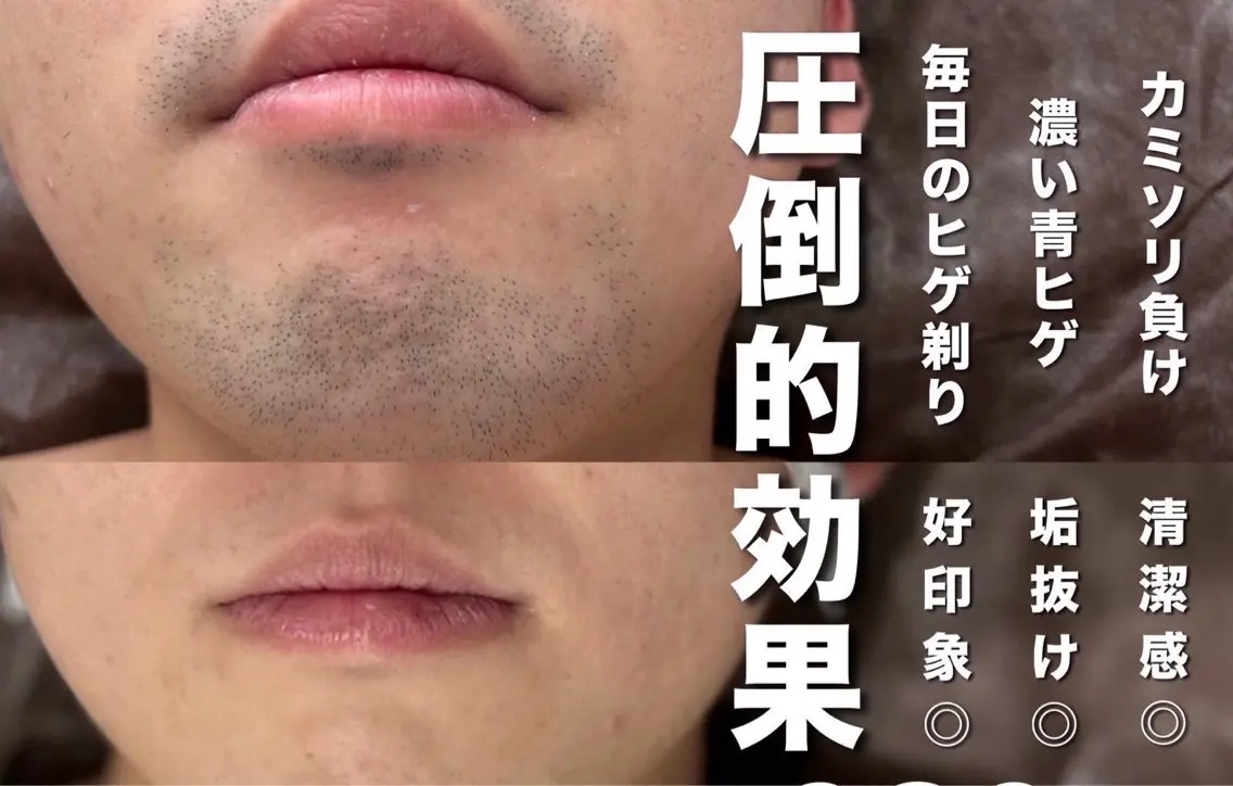 メンズ 脱毛 メンズアイブロウ BOSSのエステ・リラクイメージ