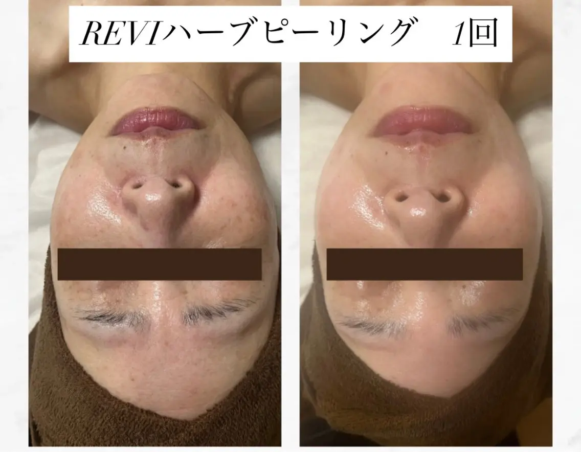 エステ 出口 玲菜のエステ・リラクイメージ