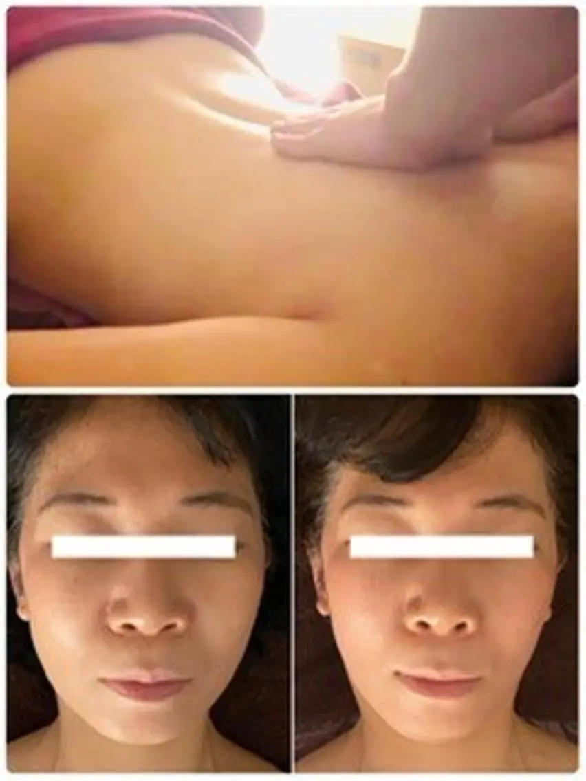 【小顔×疲れケア】痛くない小顔矯正＋マイナスイオン水ボディトリートメント✨むくみスッキリの写真