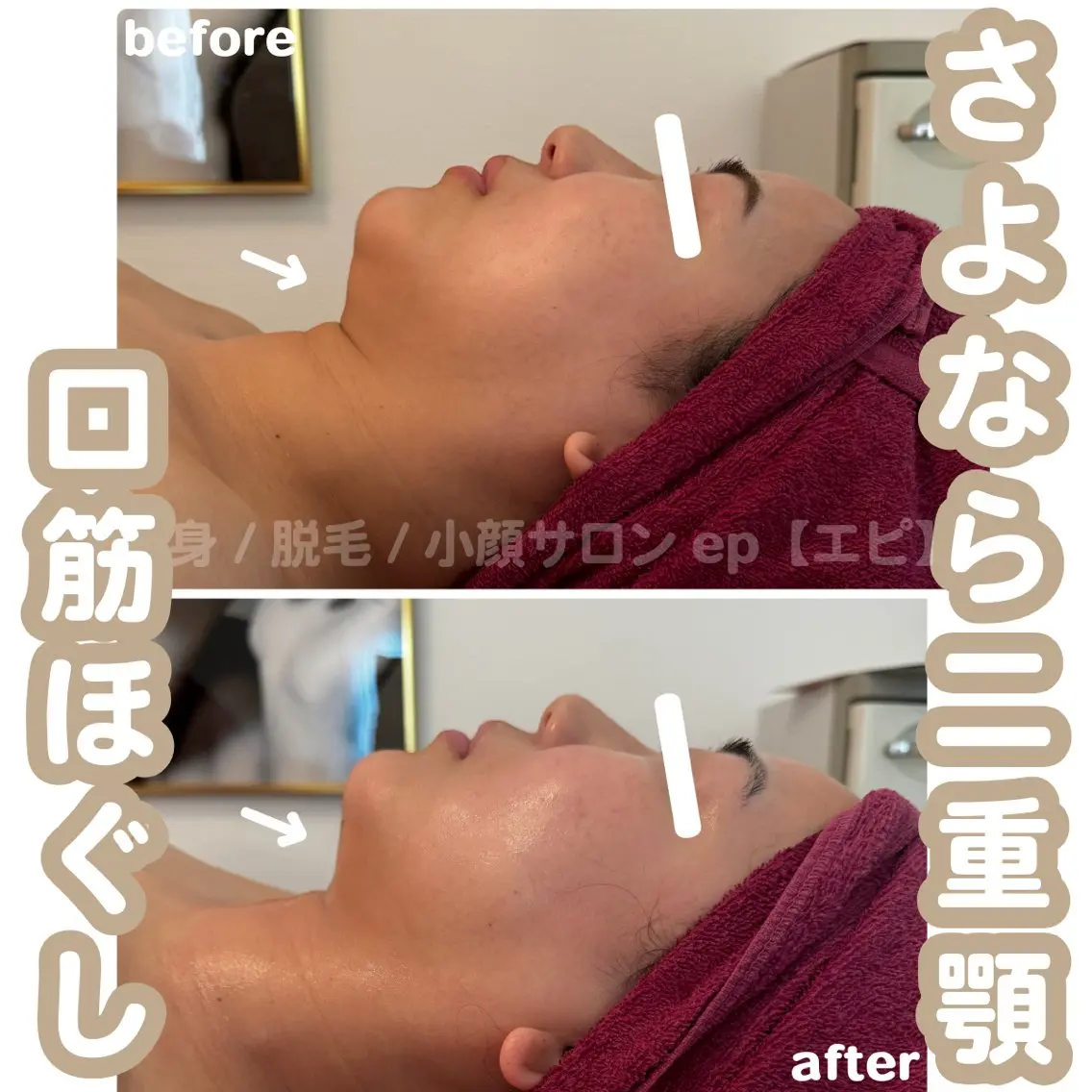 小顔リフト体験モデル募集★60分12,000→3,300の写真