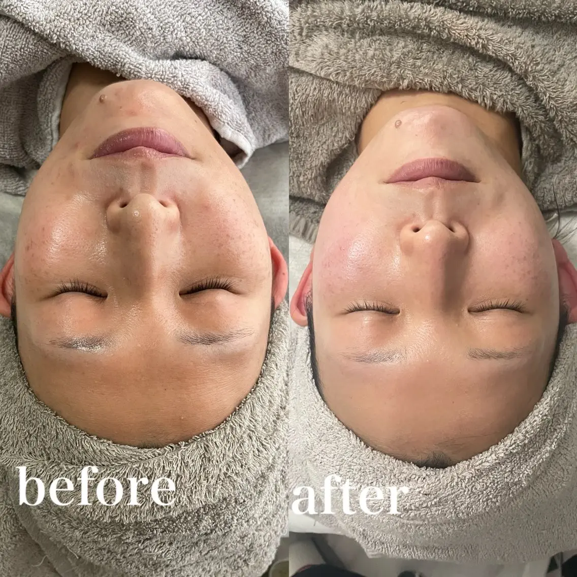 エステ SALON el 歯と肌の専門店のエステ・リラクイメージ