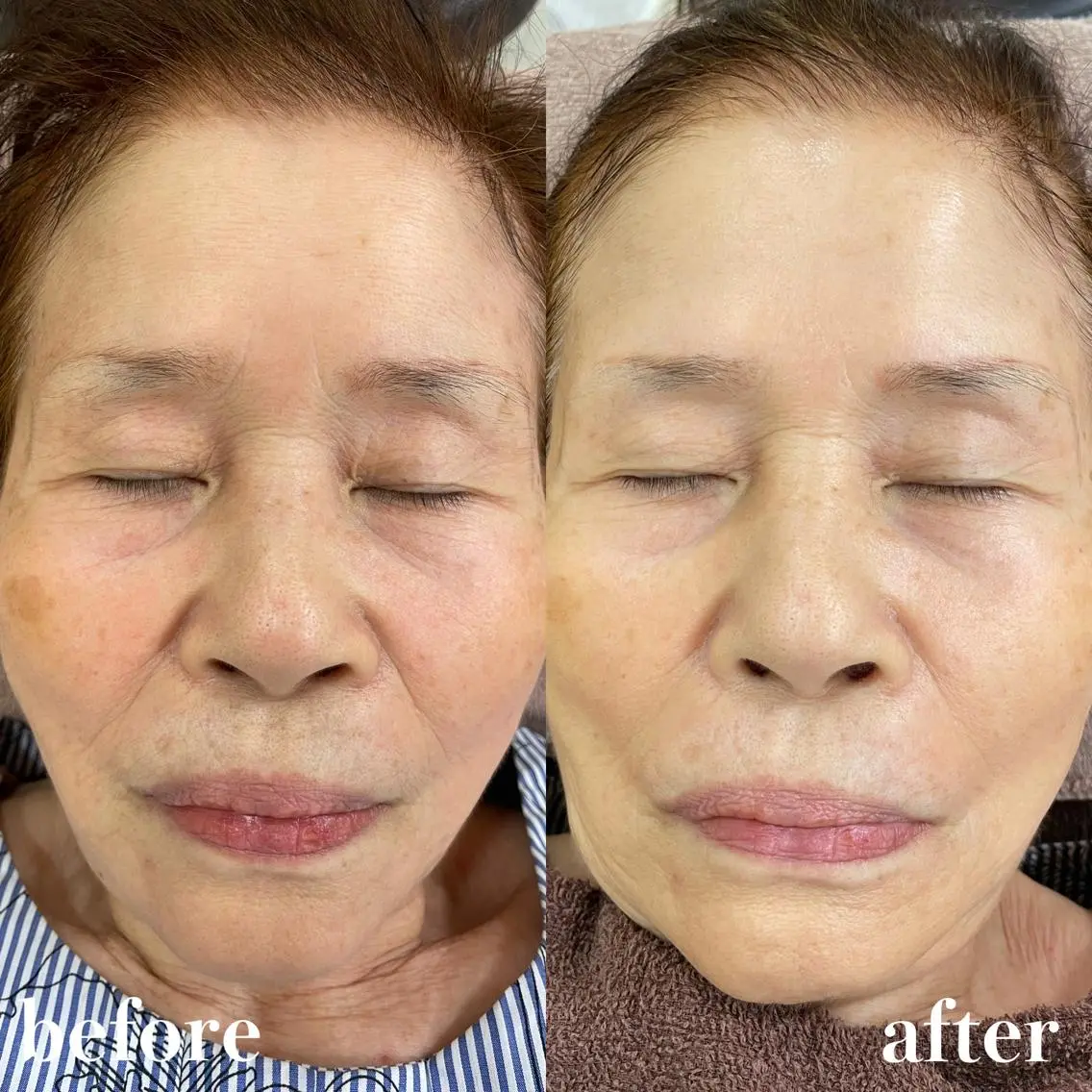 mish eyebrowのエステ・リラクイメージ