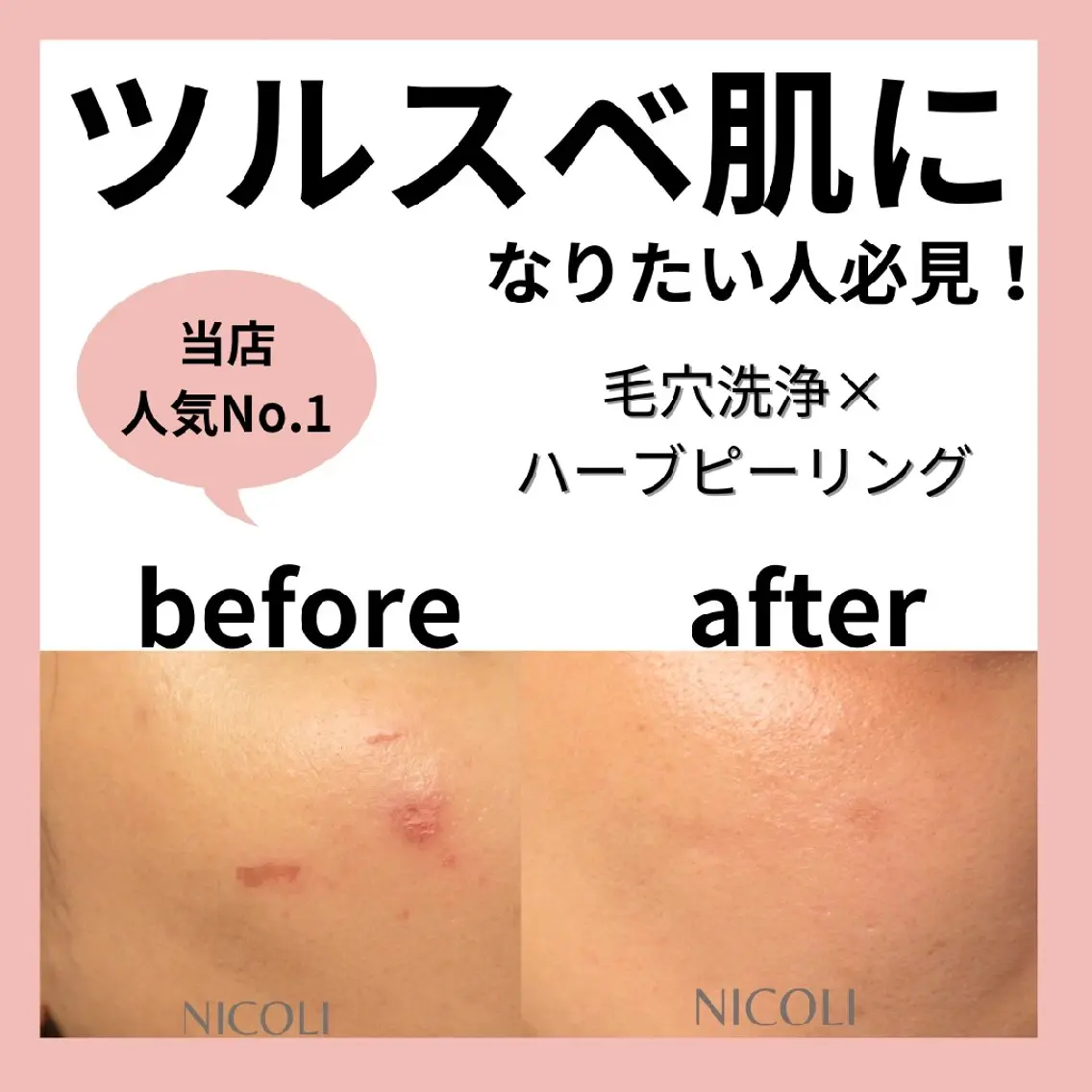 エステサロン NICOLIのエステ・リラクイメージ